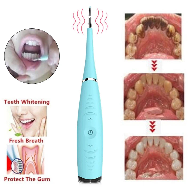 USB Vibration Sonic Dental Scaler Tartar Removal 